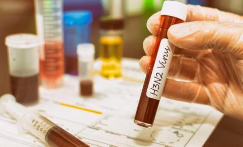 Risco de surto da gripe H3N2 é iminente em Goiás, diz Secretaria de Saúde 
